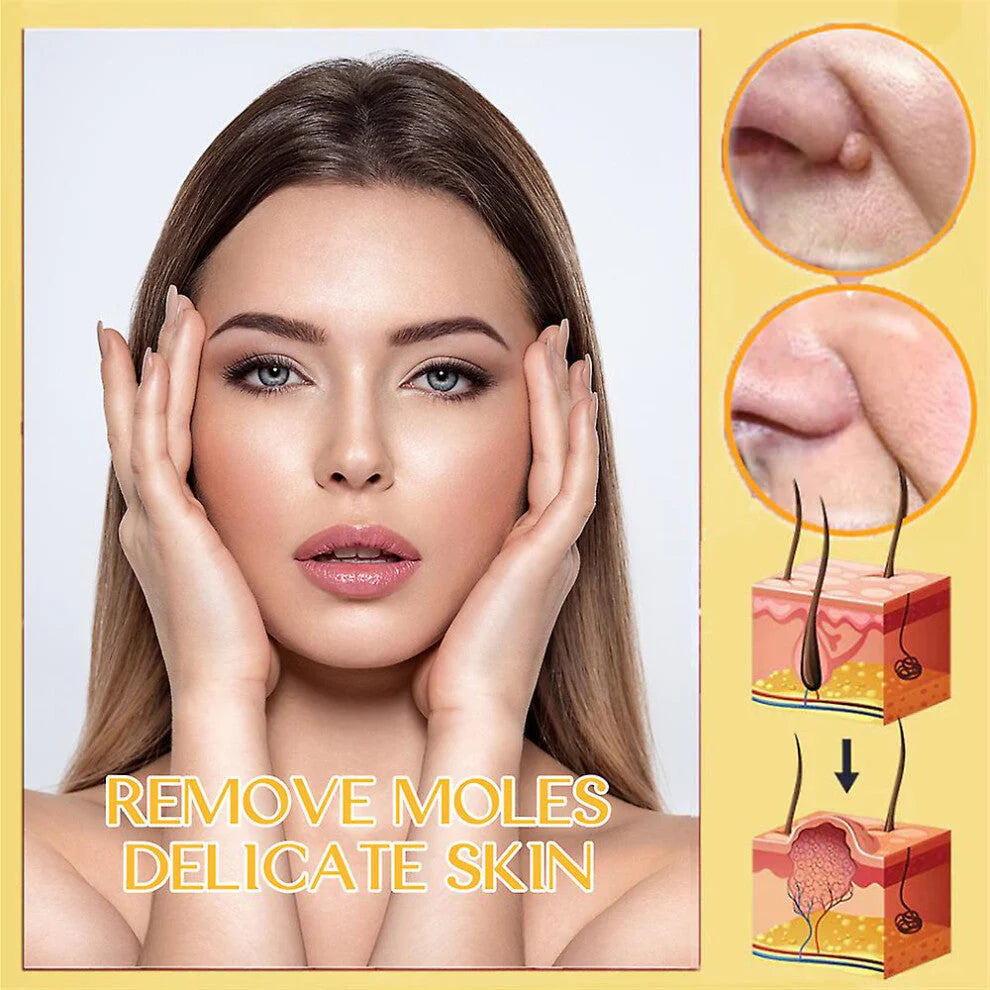 Mistfall PureSkin Tag & Mole Remover