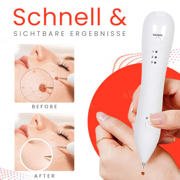 Mistfall DermaBeam Laser Pen