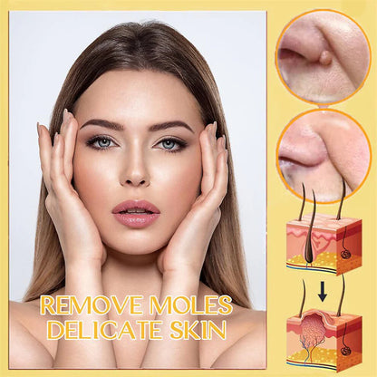 Mistfall PureSkin Tag & Mole Remover